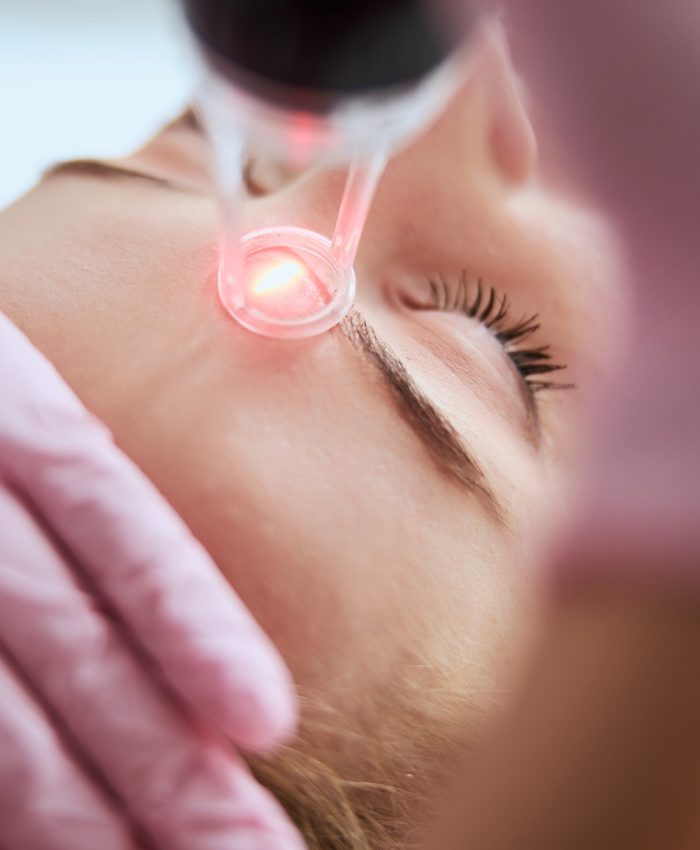 Caucasian female getting a laser skin treatment