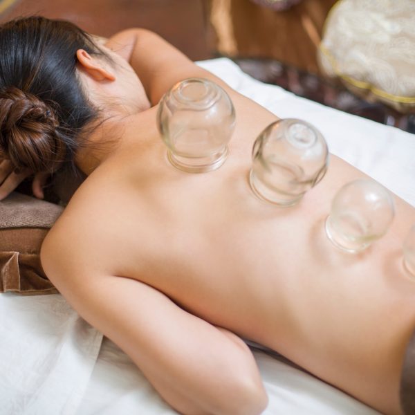 Young woman receiving vacuum cupping treatment